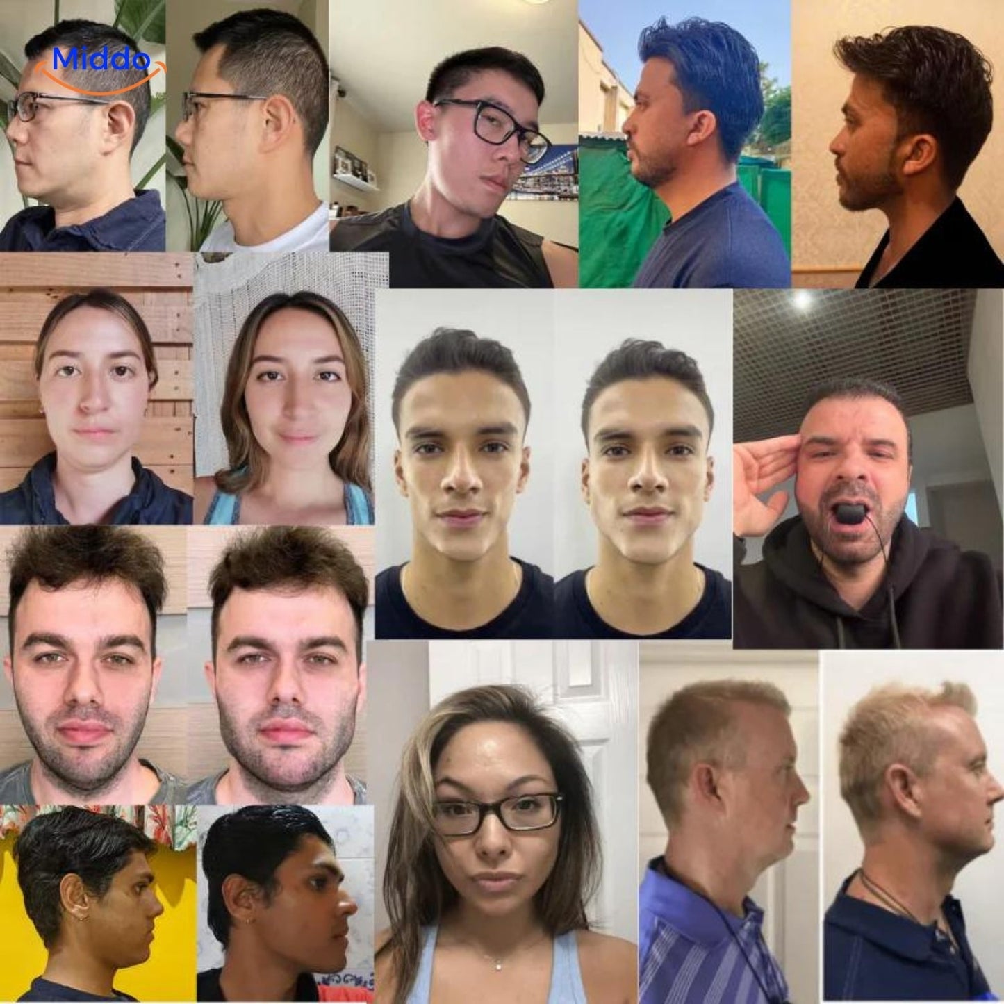 KaakMaster™ Pro Entraîneur de Mâchoire - Pour une Mâchoire Parfaite